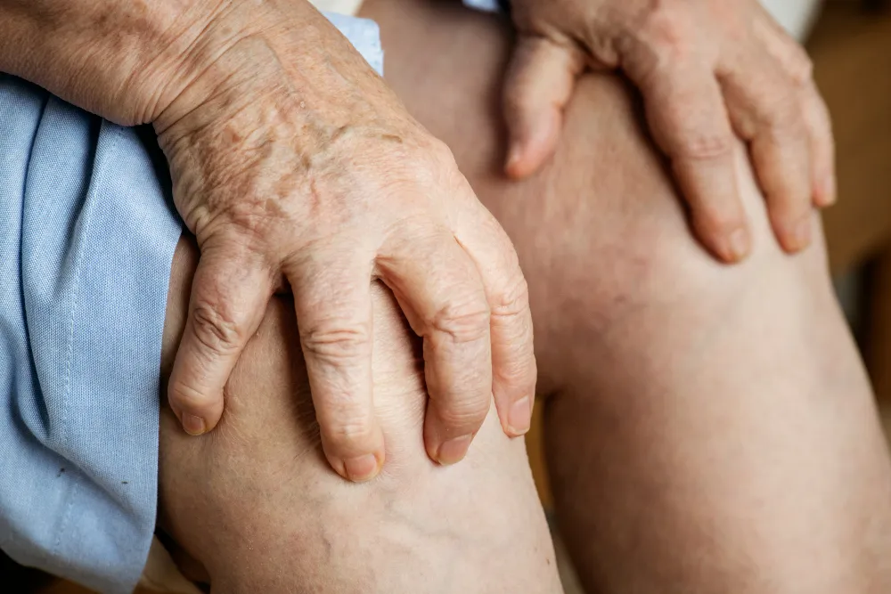 varices eletroestimulacao