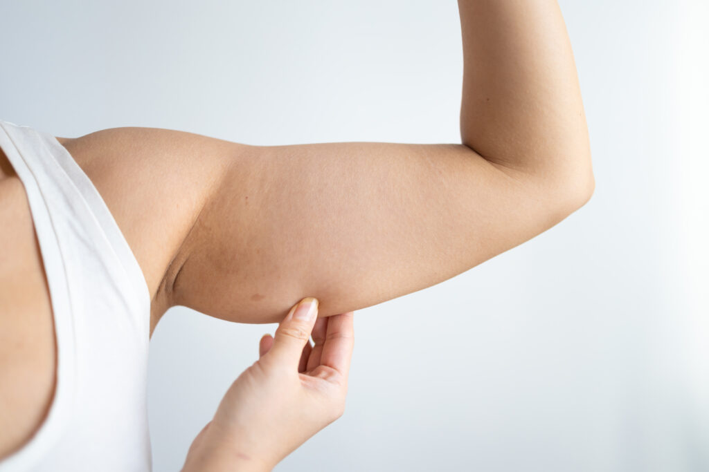 Combatting Arm Flabbiness